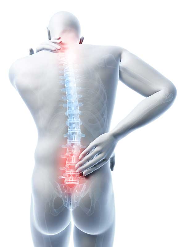 Neck and Back Pain - The Spine Clinics